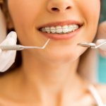 Crowns on teeth: types and advantages