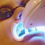 cosmetic teeth whitening magic white reviews from doctors