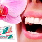 rocs denture fixation cream and its review