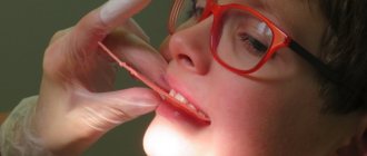 bleeding gums treatment