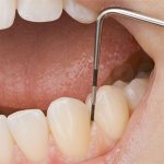 Treatment of periodontal disease