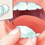 Dental treatment with folk remedies