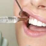 лечение зубов у кормящей мамы