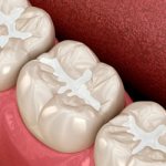 Manufacturing materials - Dentistry Smile Line