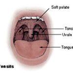 Tonsils in the mouth