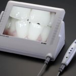 Модели и функции интраоральных камер в стоматологии
