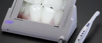 Models and functions of intraoral cameras in dentistry
