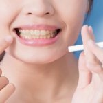 Is it possible to smoke after dental implantation?