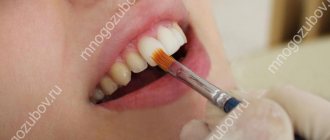 Is it possible to whiten ceramic teeth?