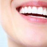 Is it possible to whiten teeth immediately after removing braces?