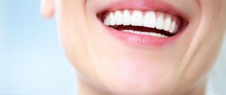 Можно ли отбеливать зубы сразу после снятия брекетов