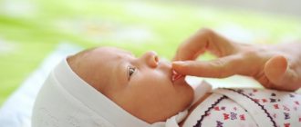callus on the upper lip of a baby