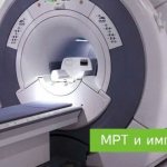 MRI and dental implantation