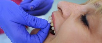 Teeth extension 2