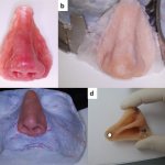 Nasal prosthesis. a) wax cast; b) polymerization; c) coloring; d) installation of magnets 