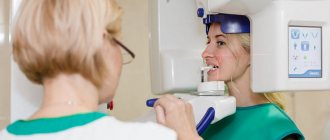Нужна ли специальная подготовка к КТ зубов?