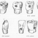general topographic scheme of cavities