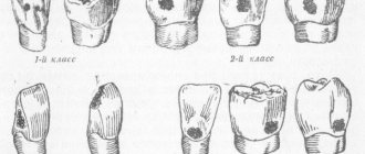 general topographic scheme of cavities