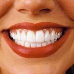 dental occlusion and malocclusion in adults