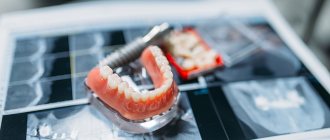 Ортодонт и ортопед в стоматологии что общего и в чем разница