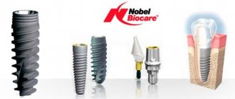 Features of Swiss implants