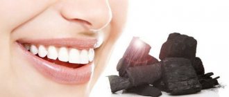 Teeth whitening with activated carbon