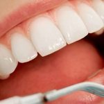 Отличие световой пломбы от обычной при лечении зубов