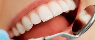 The difference between a light filling and a conventional one in dental treatment