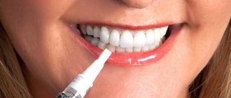 Reviews from dentists about teeth whitening pencils