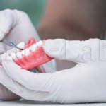 relocation of a removable denture in Moscow