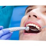 tooth canal retreatment