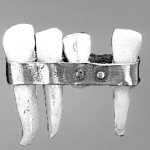 первые зубные протезы