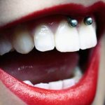 Piercing under the upper lip (smiley) on the frenulum. Photos, consequences, reviews 