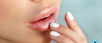 Why do lips itch and dry out?