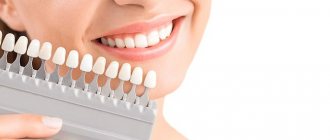 Preparing teeth for whitening
