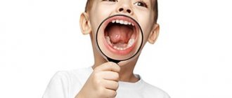 Подрезание уздечки языка у ребенка. Зачем оно нужно?
