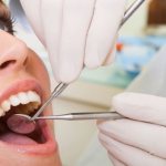 Показания к подпиливанию зубов