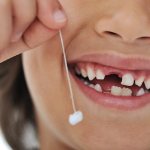 Последствия удаления молочных зубов