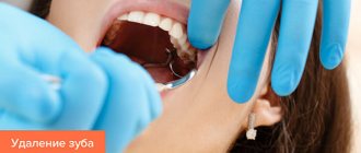 Practical advice from dentists after tooth extraction