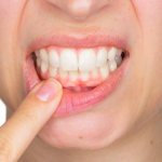 Causes of pain under the gum when pressing
