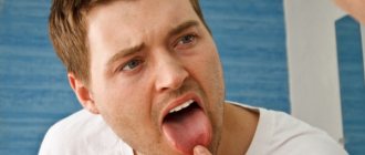 Причины появления жжения кончика языка и лечение