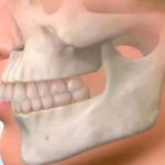 Causes of development and correction of a small lower jaw