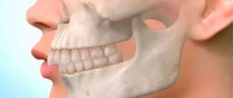 Причины развития и исправление маленькой нижней челюсти
