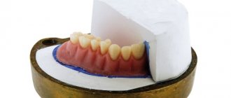 Application of fast-hardening plastics in dentistry
