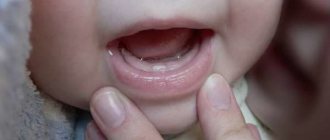 Signs of teething in a baby