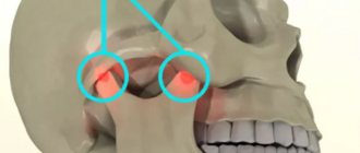 Problem areas of the temporomandibular joint