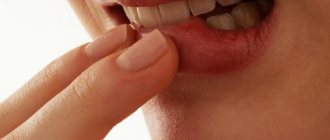 Lip cancer: symptoms and treatment