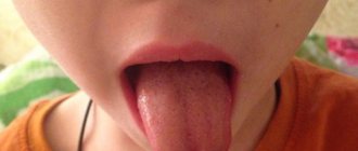 child bit his tongue