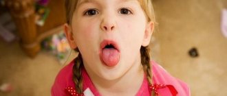 Child sticks out tongue at 3 years old
