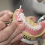 Repair of dentures